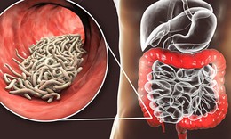 Tỷ lệ người d&#226;n nhiễm k&#253; sinh tr&#249;ng cao, Nghệ An đẩy mạnh ph&#242;ng, chống