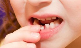 Thay răng sữa ở trẻ v&#224; c&#225;ch chăm s&#243;c đ&#250;ng