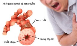 Mắc chồng ch&#233;o hen COPD, chữa thế n&#224;o?