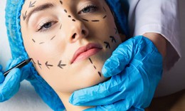 Chỉnh sửa nhẹ nh&#224;ng, xu hướng phẫu thuật thẩm mỹ l&#224;m đẹp l&#234;n ng&#244;i