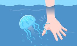 Cách cấp cứu khi đi biển bị sứa "cắn"