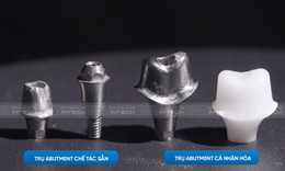 Ưu điểm vượt trội của c&#244;ng nghệ phục h&#236;nh răng sứ tr&#234;n implant DCT