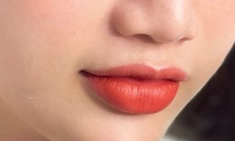 Ti&#234;m filler m&#244;i đẹp chuẩn y khoa