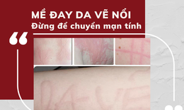 Xử l&#253; mề đay da vẽ nổi sớm trước khi chuyển sang mạn t&#237;nh