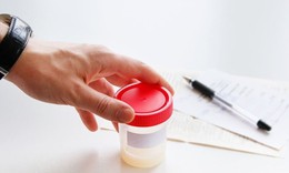 Xuất tinh ra m&#225;u c&#243; nguy hiểm? C&#225;ch n&#224;o khắc phục?