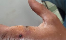 Nguy cơ b&#249;ng ph&#225;t bệnh than, Lai Ch&#226;u nghi&#234;m cấm giết mổ, vận chuyển gia s&#250;c mắc bệnh chết