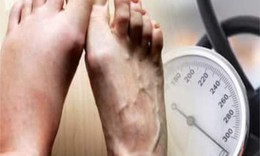 Dấu hiệu ở chân cảnh báo tăng huyết áp