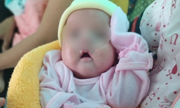 Khoa Sơ sinh Bệnh viện Nhi Đồng Cần Thơ - &#39;M&#225;i nh&#224;&#39; của trẻ sơ sinh non th&#225;ng