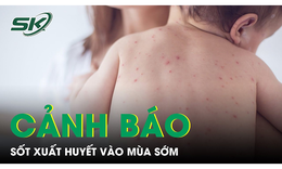 Cảnh b&#225;o sốt xuất huyết v&#224;o m&#249;a sớm