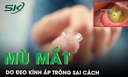 M&#249; mắt do đeo k&#237;nh &#225;p tr&#242;ng sai c&#225;ch