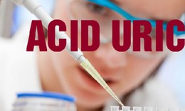 Acid uric l&#224; g&#236;, acid uric trong m&#225;u cao c&#243; nguy hiểm?