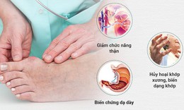 C&#244;ng nghệ mới trong hỗ trợ người bệnh gout