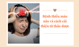 Bệnh thiếu m&#225;u n&#227;o v&#224; c&#225;ch cải thiện từ thảo dược