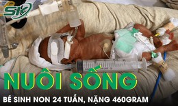 Kỳ t&#237;ch nu&#244;i sống b&#233; sinh non 24 tuần tuổi, nặng 460 gram