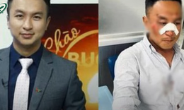 Cựu MC “Ch&#224;o buổi s&#225;ng” VTV1 bị tai nạn giao th&#244;ng đến biến dạng khu&#244;n mặt