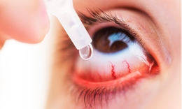 Đau mắt đỏ đang gia tăng, Bộ Y tế y&#234;u cầu xử l&#253; nghi&#234;m việc lợi dụng dịch bệnh để tăng gi&#225; thuốc