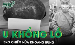 Giải tho&#225;t khối u gan nặng 3kg chiếm nửa khoang bụng cho c&#244; g&#225;i trẻ
