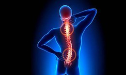 Viêm cột sống dính khớp có chữa khỏi không?