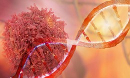 Những cách phòng chống ung thư hiệu quả