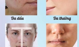 5 bước chăm s&#243;c da cơ bản gi&#250;p da hết nhăn nheo