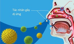 M&#249;a hanh kh&#244; ph&#242;ng vi&#234;m mũi dị ứng t&#225;i ph&#225;t