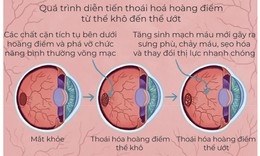 Tho&#225;i h&#243;a ho&#224;ng điểm tuổi gi&#224; - đừng bỏ qu&#234;n đ&#244;i mắt mẹ cha