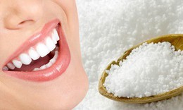 Tẩy trắng răng tại nhà cần ghi nhớ gì, bao lâu có kết quả?