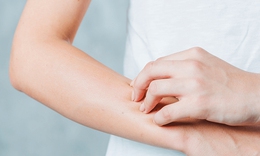 Dị ứng thời tiết có nguy hiểm không?