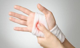 Cách sơ cứu cầm máu đúng theo khuyến cáo của bác sĩ