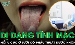 Dị dạng tĩnh mạch nằm ở lưỡi c&#243; phẫu thuật được kh&#244;ng?