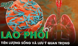 Ti&#234;n lượng sống của lao phổi v&#224; những lưu &#253; quan trọng