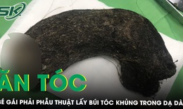 Sau 8 năm ăn t&#243;c b&#233; g&#225;i phải nhập viện cấp cứu 