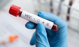 4 giải ph&#225;p thực hiện mục ti&#234;u x&#233;t nghiệm HIV đến năm 2030