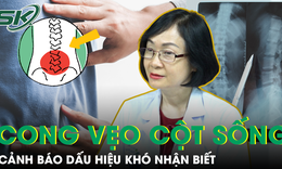 Cảnh báo những dấu hiệu cong vẹo cột sống ở trẻ cần phát hiện sớm