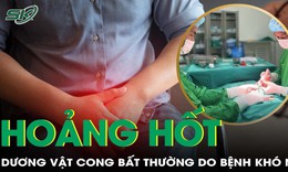 Hoảng hốt v&#236; &#39;của qu&#253;&#39; cong bất thường, đi kh&#225;m ph&#225;t hiện bệnh kh&#243; n&#243;i