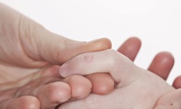 Mụn cóc ở tay chữa thế nào?