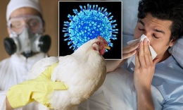 Triệu chứng nhiễm c&#250;m A/H5N1 v&#224; c&#225;c giai đoạn tiến triển của bệnh