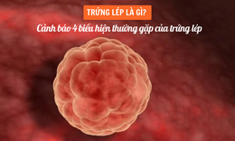 Trứng l&#233;p l&#224; g&#236;? Cảnh b&#225;o 4 biểu hiện thường gặp của trứng l&#233;p