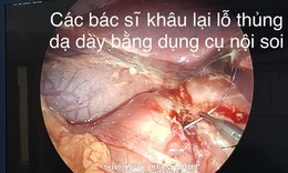 Nam sinh 15 tuổi bị thủng dạ d&#224;y v&#236; th&#243;i quen ăn đồ chua cay