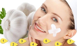 C&#225;ch xử l&#253; mụn bọc sưng đỏ tại nh&#224;