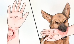 Bệnh dại kh&#244;ng c&#242;n cơ hội sống khi ph&#225;t bệnh, c&#225;ch chủ động ph&#242;ng ngừa