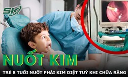 Trẻ 8 tuổi nuốt phải kim diệt tuỷ khi đi chữa răng