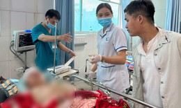 Cập nhật mới nhất về sức khỏe 5 c&#244;ng nh&#226;n vụ nổ l&#242; hơi ở Đồng Nai đang điều trị tại bệnh viện 