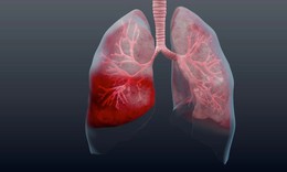 Nạn nhân vụ cháy ở Trung Kính bị bỏng hô hấp, bệnh nguy hiểm thế nào?