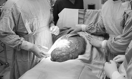 Nam thanh niên chủ quan tưởng béo bụng, bác sĩ mổ ra khối u 8kg, đường kính 40cm