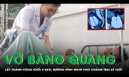 Vỡ bàng quang do uống bia quá mức, phải phẫu thuật gấp