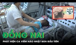 Đồng Nai: Ph&#225;t hiện ca vi&#234;m n&#227;o Nhật Bản đầu ti&#234;n