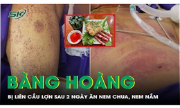 Bị li&#234;n cầu lợn sau 2 ng&#224;y ăn nem chua ở qu&#225;n bia