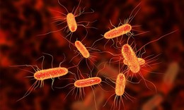 Biểu hiện nhiễm khuẩn E.coli, cách phòng tránh nhiễm E.coli trong mùa hè