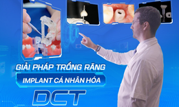 Giải ph&#225;p trồng răng implant c&#225; nh&#226;n h&#243;a DCT - Xu hướng trồng răng thế kỷ XXI